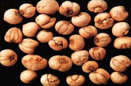 �������Y